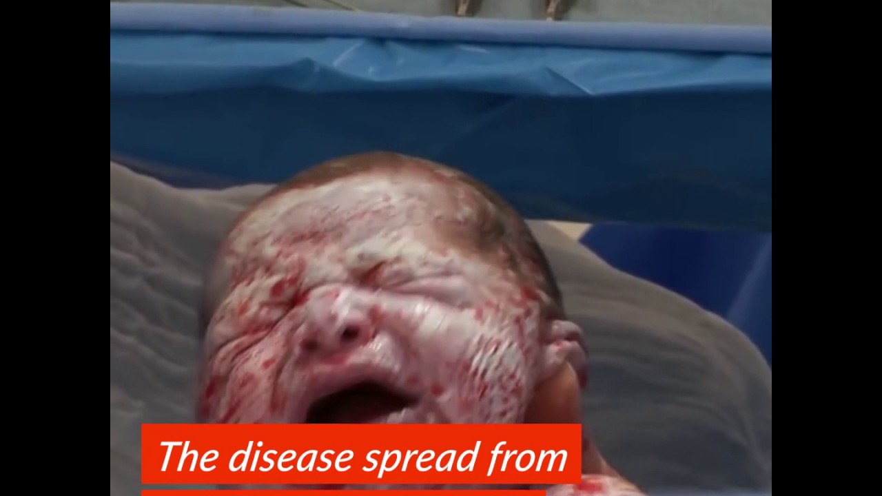 camera iphone 8 plus apk Anti-Vacciners Blamed For Measles Outbreak