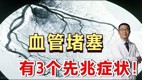 血管堵塞会形成心梗、脑梗，有3个先兆症状！心血管医生却说：每一个都足以致命！ - 天天要闻
