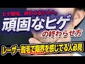 【医師解説】ヒゲが減らない人へ｜レーザーで終わらない“最後の脱毛”は絶縁針脱毛です