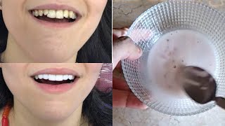 Say goodbye to a dentist with a home whitening recipe in less than 3 minutes and the result will imp