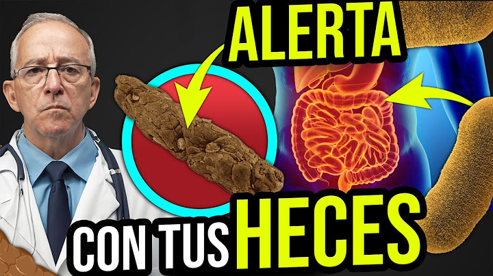 💩 CUIDADO Esto Dicen Tus HECES De Tu Salud - Oswaldo Restrepo RSC