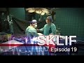 Sklif (E19) A rare double-organ transplant operation.