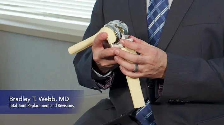 Dr. Bradley T. Webb Explains Knee Replacement Surg...