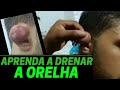 Tutorial: Como drenar a orelha estourada - jiu jitsu