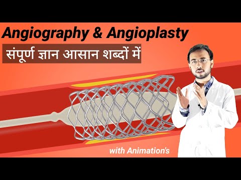जानिए Angiography & Angioplasty kya hai or kaise hoti hai | Angiography test procedure | angioplasty