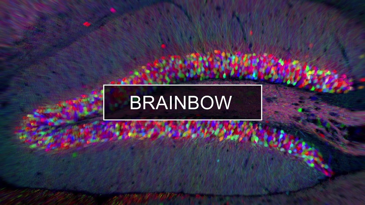 Mapping The Human Connectome