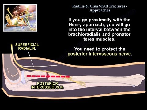 Radius & Ulnar Shaft Fracture Approaches  - Everything You Need To Know - Dr. Nabil Ebraheim