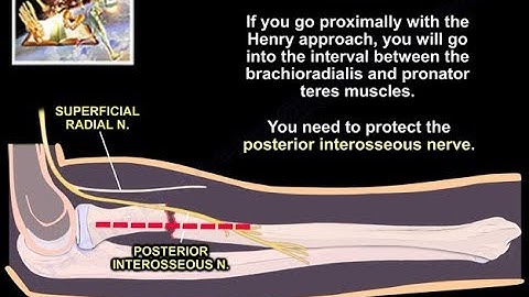 Radius & Ulnar Shaft Fracture Approaches  - Everything You Need To Know - Dr. Nabil Ebraheim