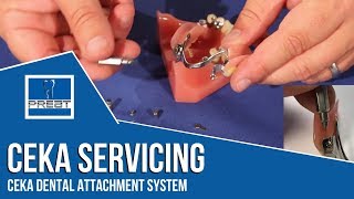 Ceka Servicing - Working with the Ceka Dental Attachment System By PREAT Corporation
