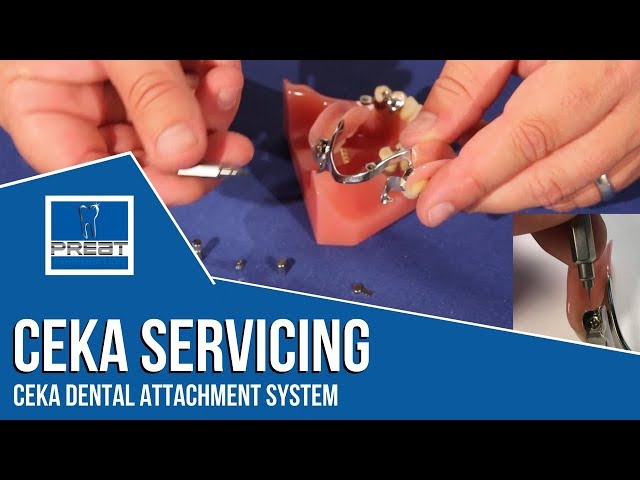 Ceka Servicing - Working with the Ceka Dental Attachment System By PREAT Corporation class=