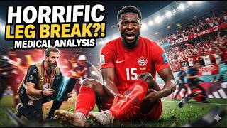 🚨 Ishmael Koné's World Cup Tibia Fracture: Medical Analysis &amp; Recovery Timeline #IshmaelKone