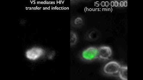 Time lapse images of T cell synapse resulting in infection 32 hours later