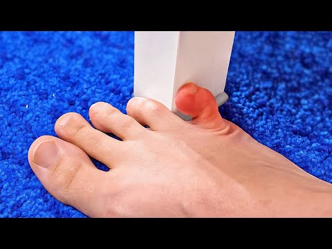 FIRST AID HACKS || 23 Safety Tricks For Common Problems