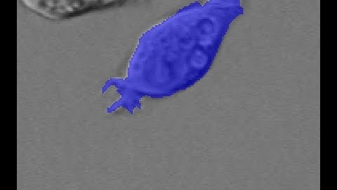 Generating C code for cell detection algorithm in MATLAB