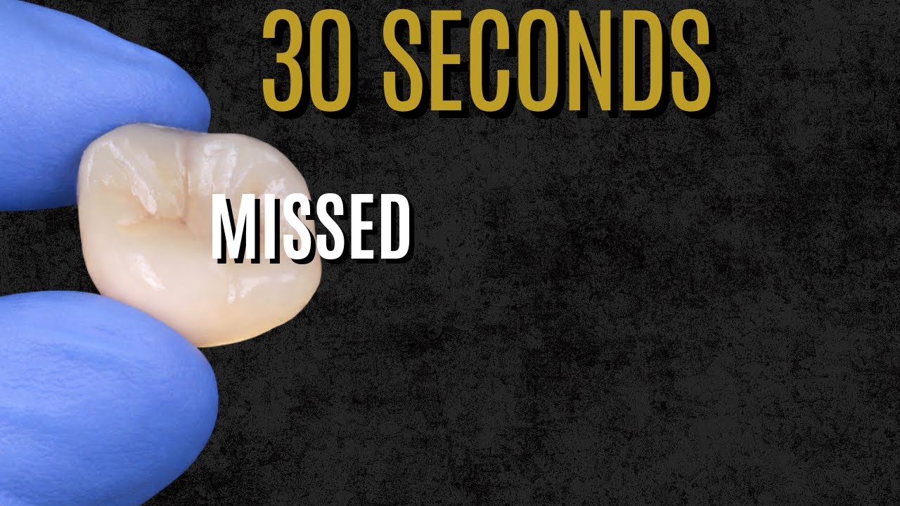 Боль в челюсти после установки коронки — 30 секунд, которые могли бы изменить ситуацию | 