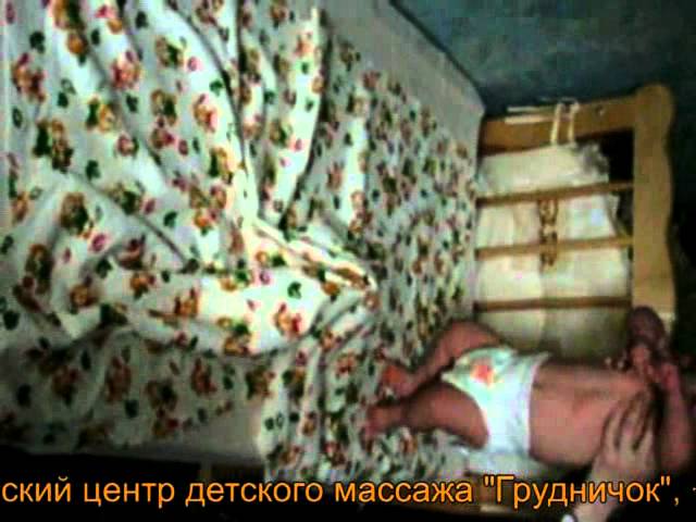Спастическая мышечная кривошея, ишемическая энцефалопатия до и после массажа. Массаж новорожденного.