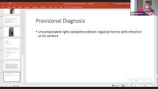PG Masterclass- Case on Inguinal Hernia
