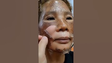 🔥Naturally Remove Dark Spots/Pigmentation 😱 | Best Remedy ✅ #shorts #youtubeshorts #skincare