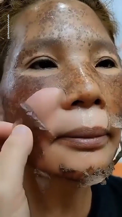 🔥Menghilangkan Flek Hitam/Pigmentasi Secara Alami 😱 | Solusi Terbaik ✅ #shorts #youtubeshorts #perawatankulit