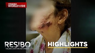 Ginang mula sa Pampanga, nabiktima raw ng isang 'di lisensyadong dermatologist?! | Resibo