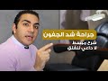 A Simplified Explanation Of Eyelid Lift Surgery By Dr Sherif Hegazy 