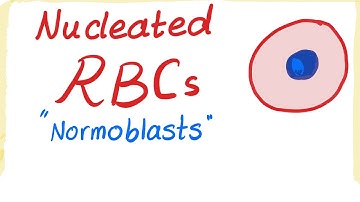 Nucleated RBCs (Normoblasts)