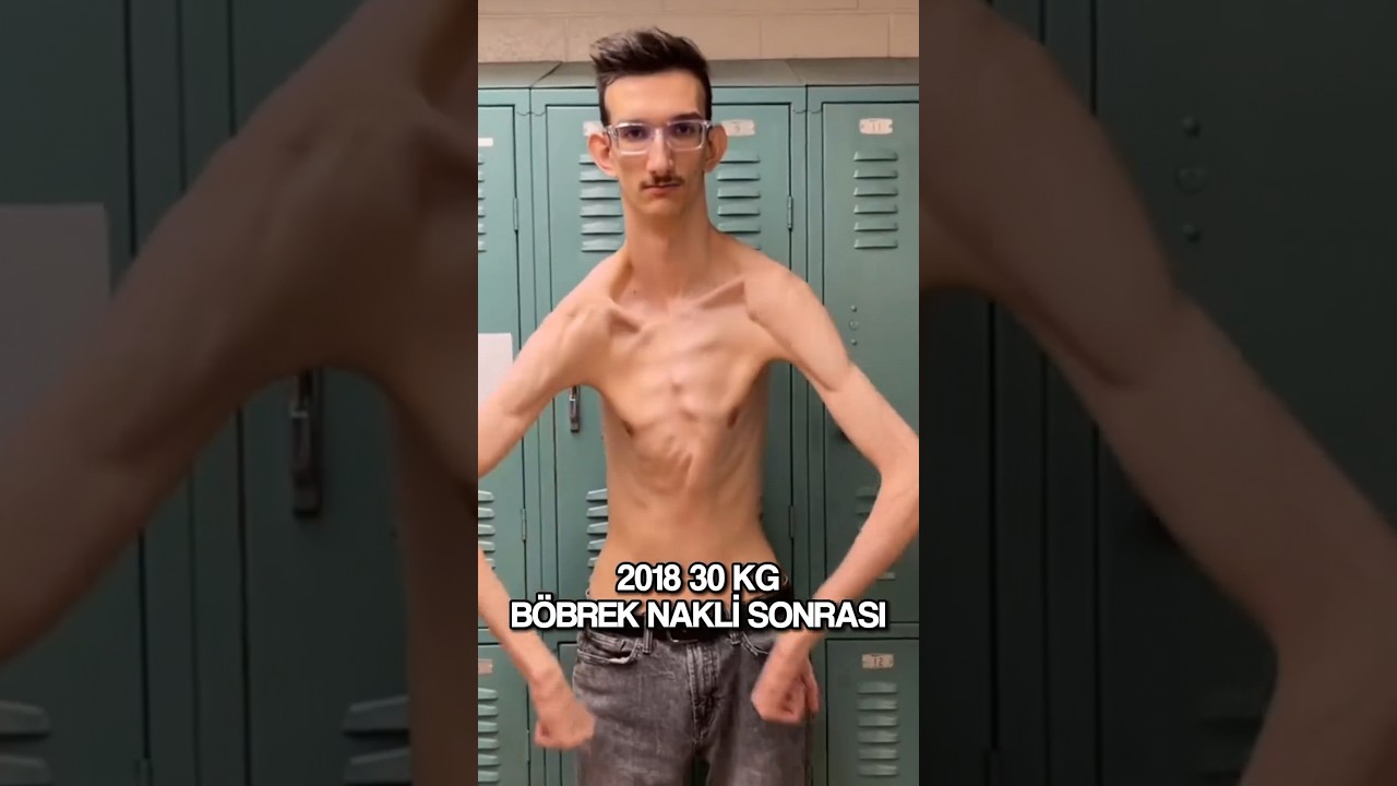 Crazy Transformation 😧 