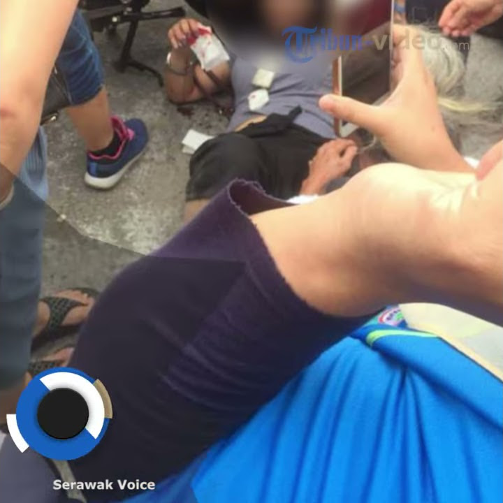 Dijambret saat Jalan, Seorang Wanita Terjatuh dan Rambutnya Tersangkut di Rantai Motor Pelaku