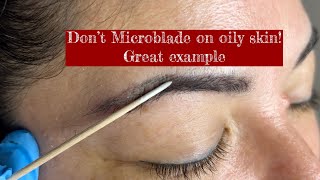 What will happen if you Microblading oily skin? Here is a great example of how to correct this!