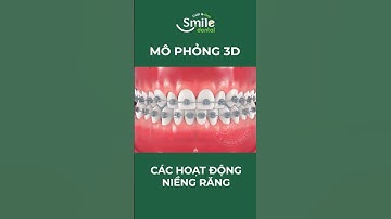 MÔ PHỎNG QUÁ TRÌNH NIỀNG RĂNG. NHA KHOA SMILE DENTAL.