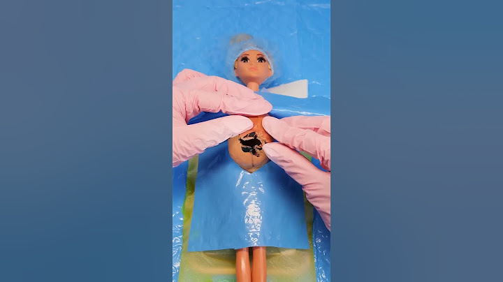 My surgeon learned from 5 minute crafts videos😥