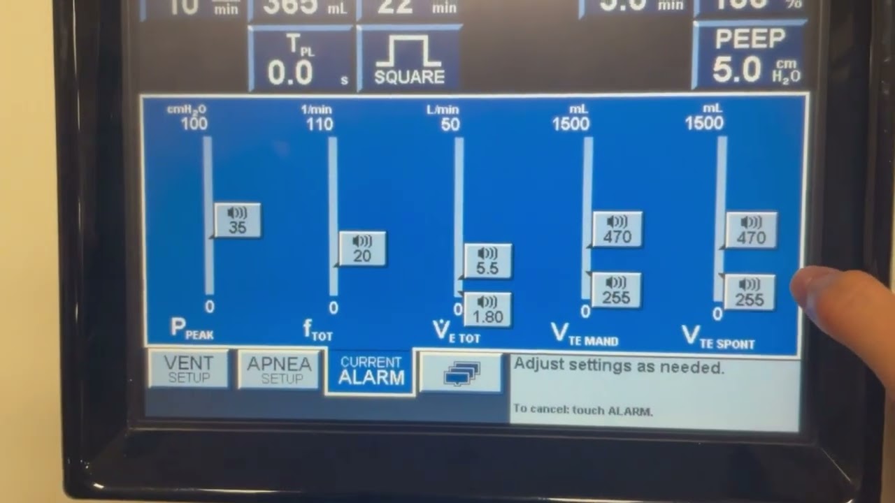 Puritan Bennett 840 Ventilator Setup