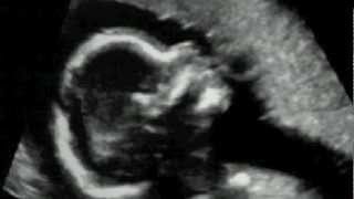 Samir Take 1 Movie Trailer