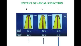 Endodontic Surgery Part 2