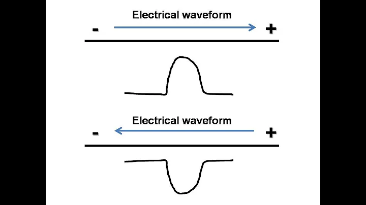 ECG course: Basics of ECG, Dr. Sherif Altoukhy