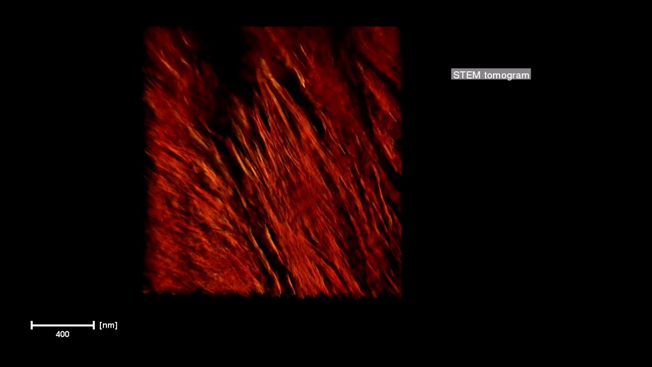 Revealing the remarkable nanostructure of human bone (1 short)