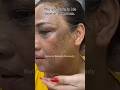 Erase dark spots fast naturally 🌿 Get clear glowing skin with this easy DIY beauty secret! #ytshorts