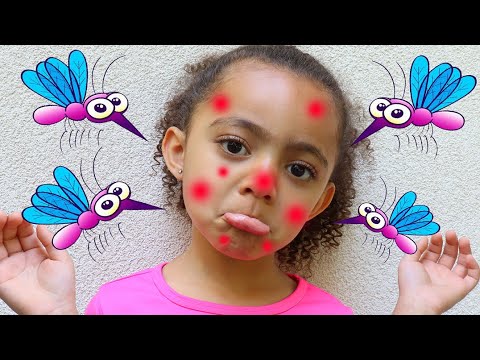 I'm So Itchy Nursery Rhymes Song | More Nursery Rhymes and Children's Songs thumbnail