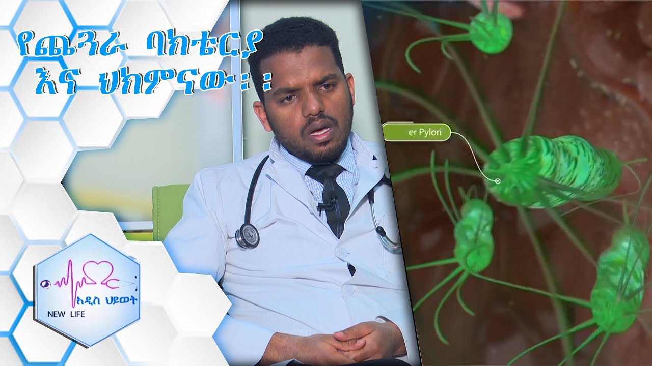 የጨጓራ ባክቴሪያ እና ሕክምናው/ NEW LIFE EP 302