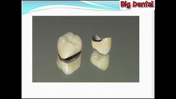 8 nguyên tắc sửa soạn cùi răng hoàn hảo(Phần 2/2)