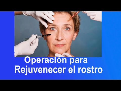 Vídeo: Dom-2: Construeix La Teva Pròpia Cara: Les Cinc Millors Transformacions Dels Participants Del Televisor, Que Es Van Fer Irreconocibles Després De La Cirurgia Plàstica