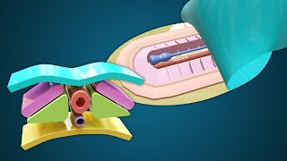 Somites & Somitogenesis - Intraembryonic Mesoderm in Third Week - 3D Human Embryology