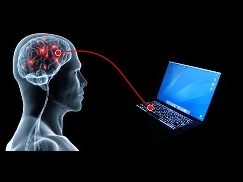 ტვინის ნეიროიმპლანტი (ჩიპი) ჯანმრთელობისთვის