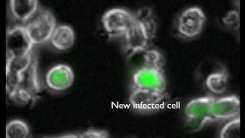 Several Time lapse images of HIV synapses that result in infection