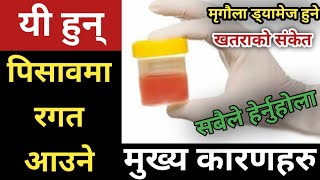 Nepali Health Tips: यी हुन् पिसावमा रगत आउने मुख्य कारणहरु | Blood in Urine, Hematuria