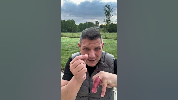 Stuck Ring? This Genius Trick Will Save Your Finger!