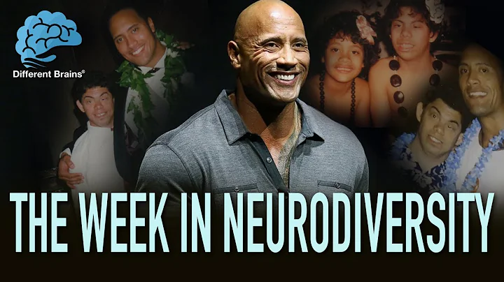 Dwayne The Rock Johnson Honors Friend With Down Sy...