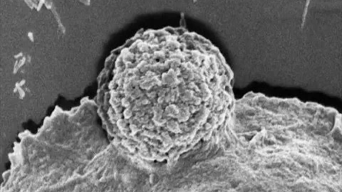 Mechanogenetics/ Cell, May 12, 2016 (Vol. 165, Issue 6)