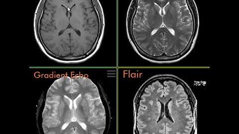 T1, T2, FLAIR, and Gradient Echo pulse sequences.