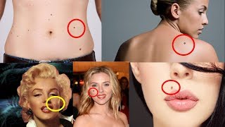 शरीर के अंगों के तिल, क्या दर्शाते हैं ? Moles On Body Reveal About your behaviour and Personality